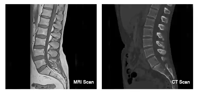 Which is better? MRI or CT scans?
